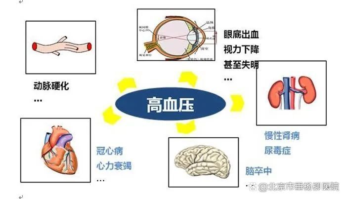 垂医科普|血压多高就是高血压啦?如何正确测量血压,牢记4个要点_北京日报网