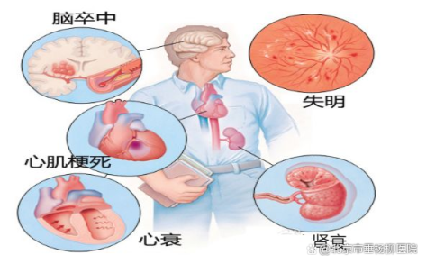 垂医科普 | 一文读懂高血压患者怎样智慧生活_北京日报网