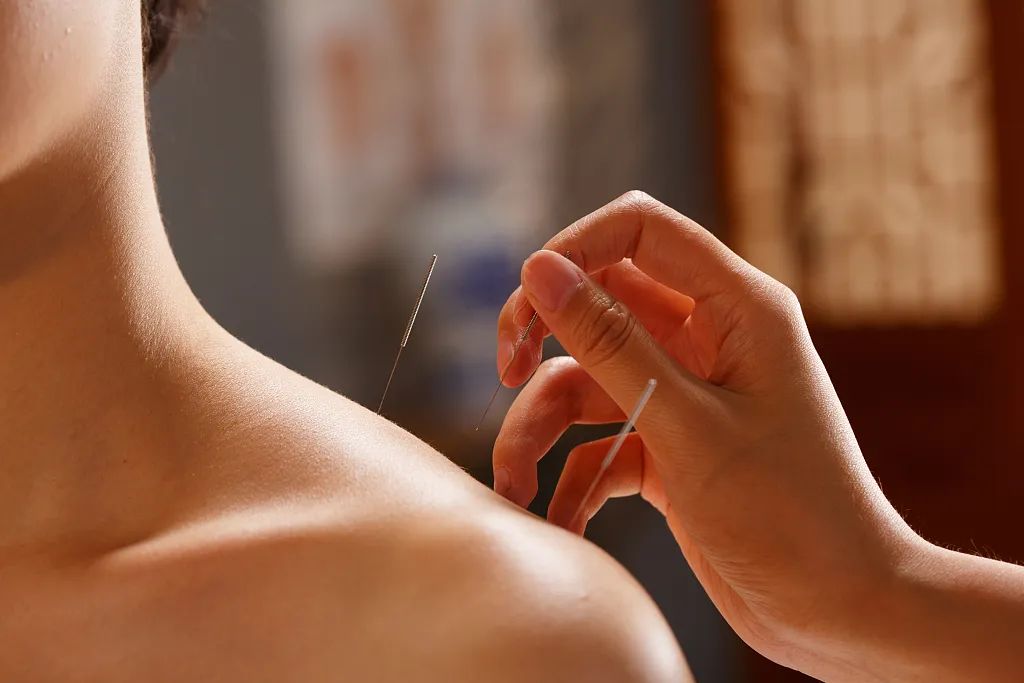 中医针灸为何能够针服全球