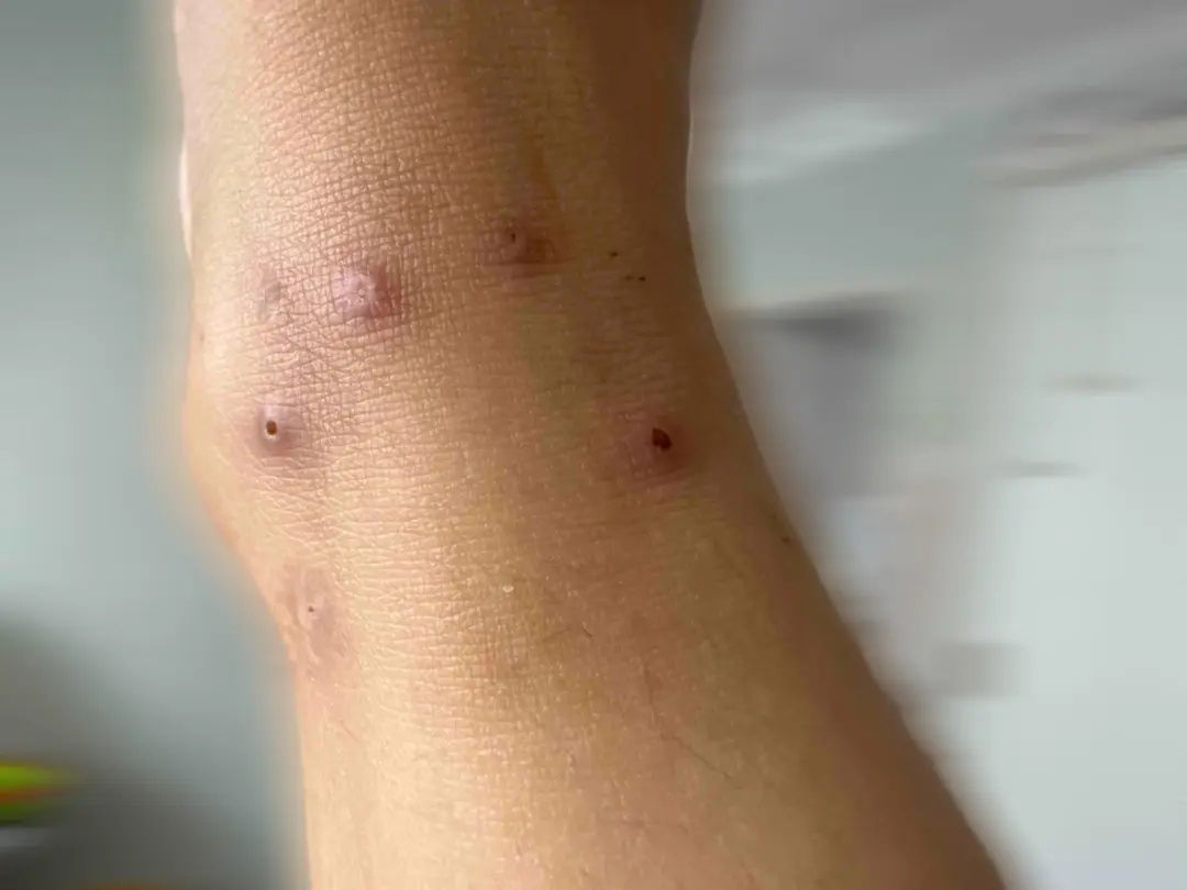 红火蚁已入侵12个省份,有致命危险!紧急提醒